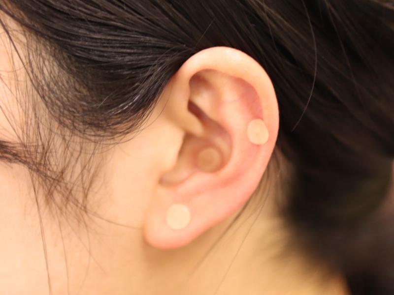 耳ツボの画像